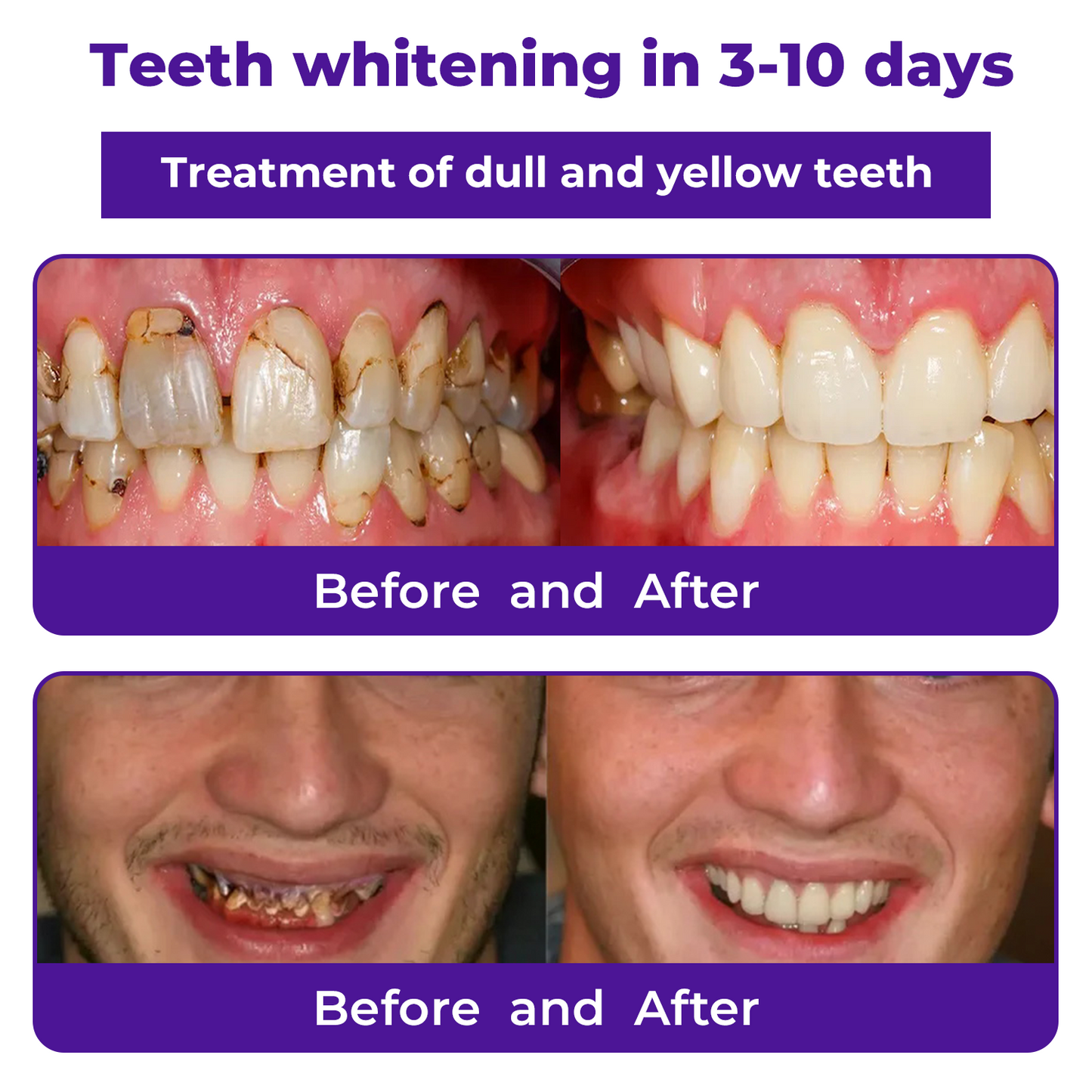 š¦·DobshowĀ® Dental Repair Mineral Powder >> š„Buy 1 Get 1 Freeš„