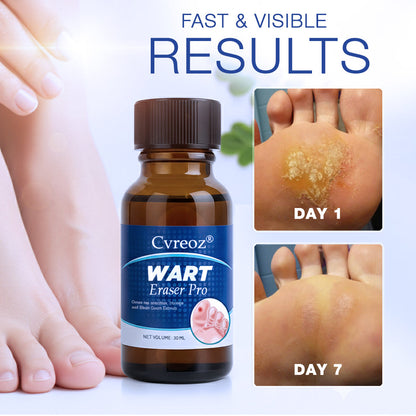 Cvreoz® Wart Eraser Pro