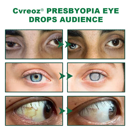 Cvreoz® Clear Life Eye Drops