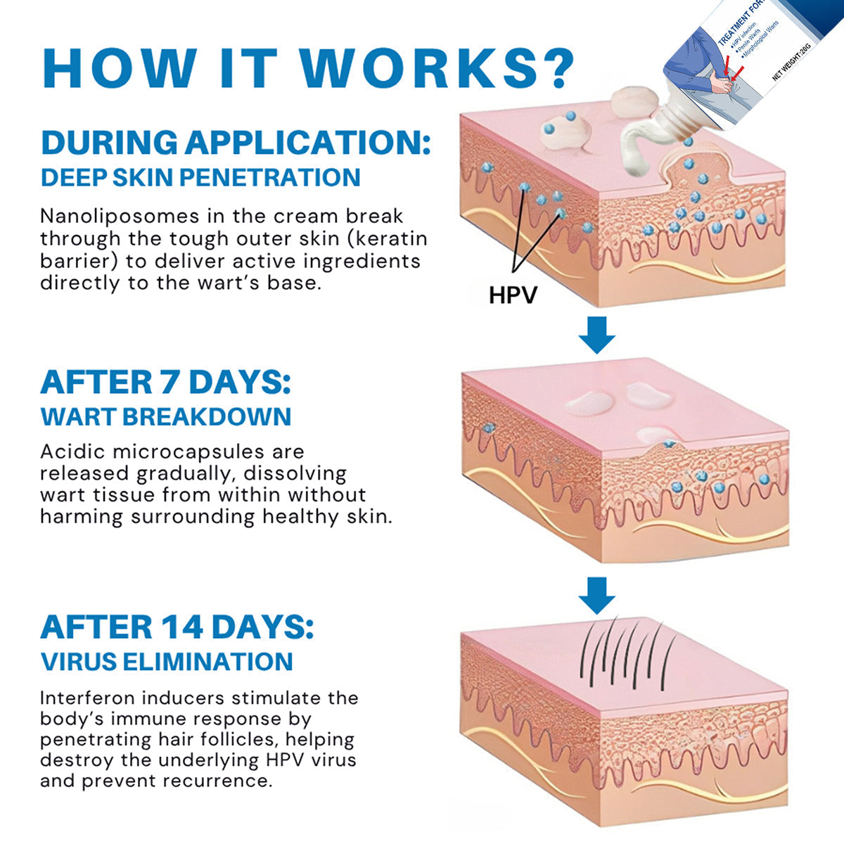Cvreoz® HPV Genital Warts Relief Cream