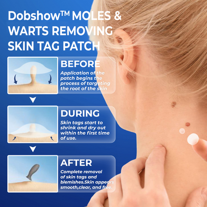 Dobshow™ Moles & Warts Removing Skin Tag Patch >>✅ 60%OFF