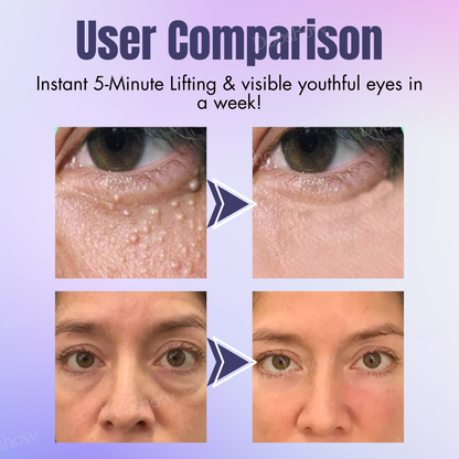 Dobshow™ Collagen+ Bee Venom Eye Cream Roll On