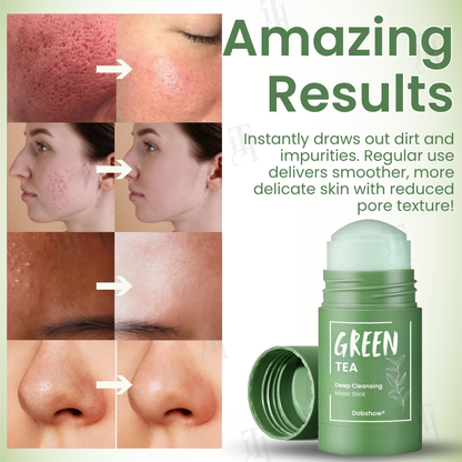 💥Final Sale🍵 - Dobshow® Green Tea Deep Cleansing Mask Stick