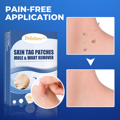 Dobshow™ Moles & Warts Removing Skin Tag Patch >>✅ 60%OFF