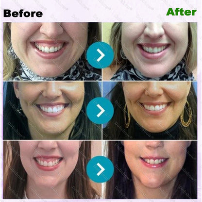 `🐝 Dobshow® ApiCore BeeVenom Vital Repair Toothpaste