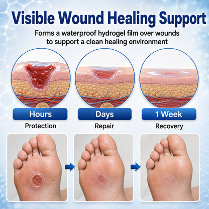 👨‍⚕️🩹Healrize® Advanced Barrier Spray | Fast-Drying Liquid Bandage for Wound Care