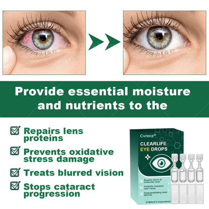 Cvreoz® Clear Life Eye Drops