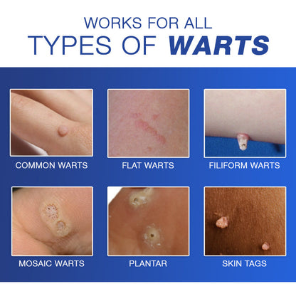 Cvreoz® Wart Eraser Pro