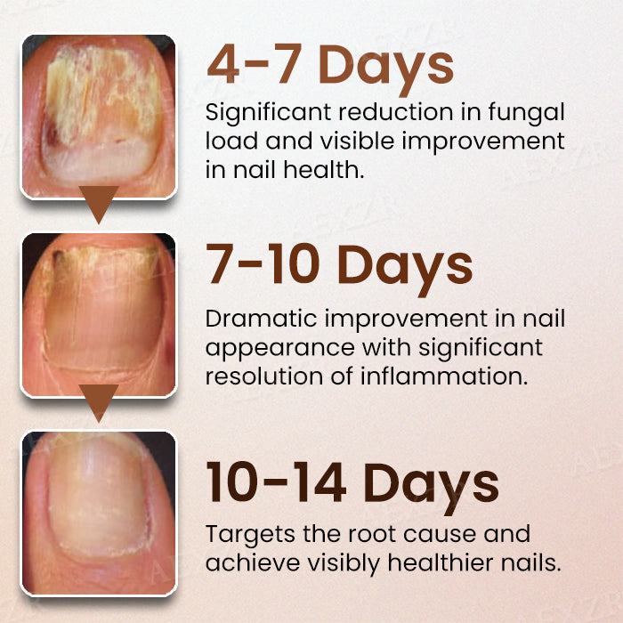 Piguiay® Nails Repairing Serum