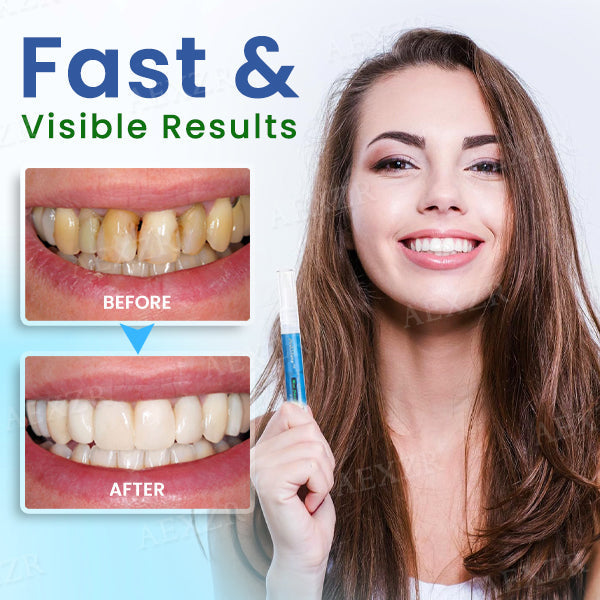 Dobshow® Teeth Whitening Pen