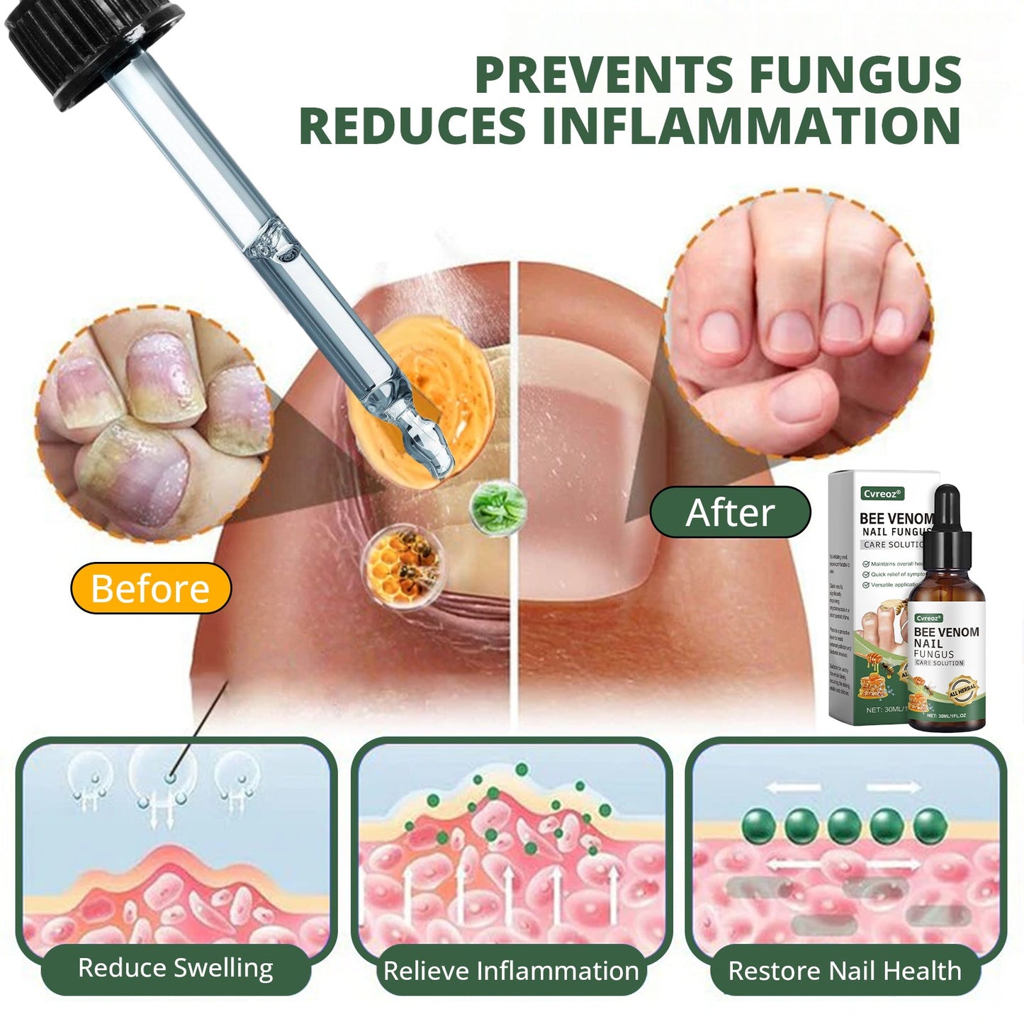 Cvreoz® Bee Venom Nail fungus care solution ：Natural Formula for Toenail & Fingernail Care