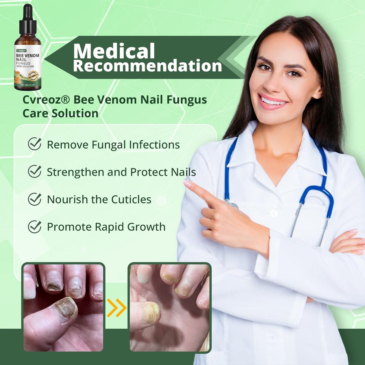 Cvreoz® Bee Venom Nail fungus care solution ：Natural Formula for Toenail & Fingernail Care