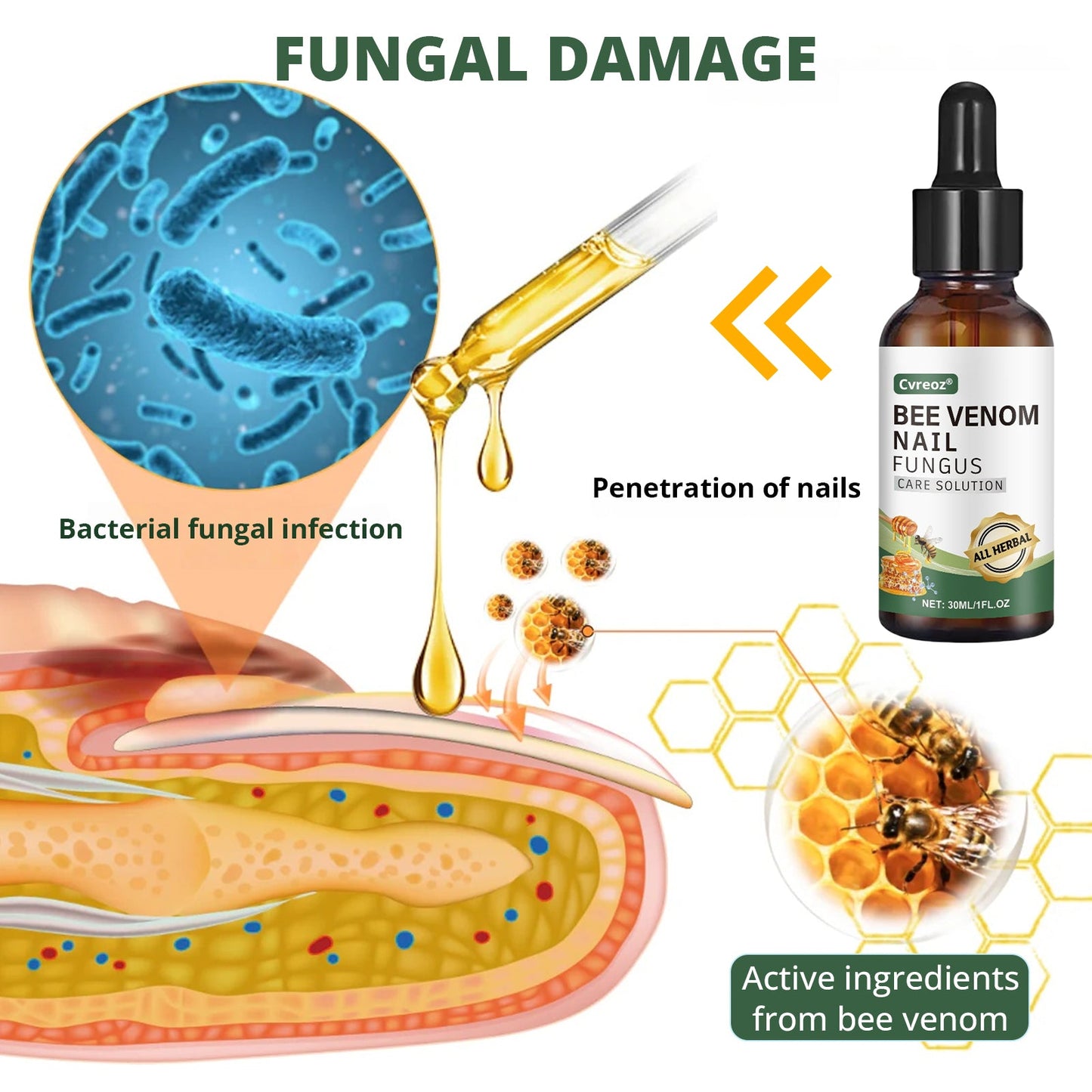 Cvreoz® Bee Venom Nail fungus care solution ：Natural Formula for Toenail & Fingernail Care