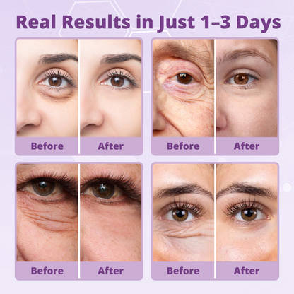 🔥LIMITED SPECIAL OFFER🔥 Dobshѳw® Instant Filter Eye Firmer