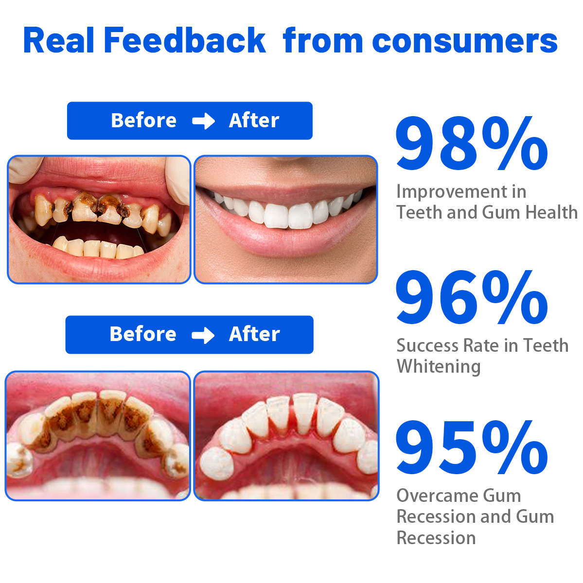 🦷 Dobshow® SmartSmile Bee Venom Whitening & Repairing Toothpaste